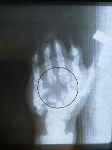 x ray